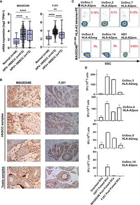 DNA Vaccines Targeting Novel Cancer-Associated Antigens Frequently Expressed in Head and Neck Cancer Enhance the Efficacy of Checkpoint Inhibitor